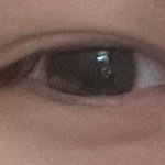 <b>눈밑</b> 누르면 ㄹㅇ 애교살생김