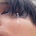 [모두드루와] 보플 이상원 <b>레이저제모</b> 안했나봐