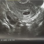 [엔터톡] 의식 있는 배우인 척 그만하시고 <b>민낯</b>을 좀 드러내세요