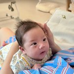 ‘임현태’ 레이디제인 쌍둥이 딸 혈관종에 걱정 “3달 <b>뒤</b> 병원行”