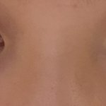 다크<b>써클</b> 어케 없애냐..ㅠㅠ