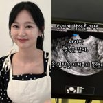 '변호사' 오초희, 임신 7주 차에 <b>유산</b>했다…"피에 물들까 봐...