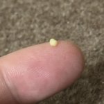 [댓글부탁해] <b>재채기</b>했는데 목에서 이거 나옴