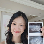 전수민김경진, 쌍둥이 부모 된다..임밍아웃 “소중한 아기<b>천사들</b>”