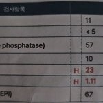 [하고싶은말] 용서못해!