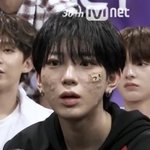 보플 얘 피부왜<b>이럼</b>?