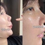 허안나, 코 재수술 고백 “이렇게 됐어요”[<b>SNS</b>는 지금]