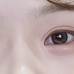 이거 쌍수 <b>아웃라인</b> 극단적 망 케이스임..?