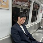 이동욱 무슨 일?..얼굴에 <b>피범벅</b> 상처→지하철서 목격 [스타이슈]