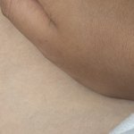 와 나 피부 ㅈㄴ탔는데 어캄