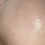 얼굴에 이런 <b>핏줄</b> ㅈㄴ잘보이는데