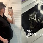 ‘쌍둥이 임신’ 지소연, <b>태아</b> 크기에 애타는 마음…“좀 더 커줘”