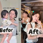 '이지훈' 아야네, 렌스<b>삽입</b>술 수술 후 광명 찾았다 "왜 이제서야...