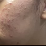 혐주의) 나 피부 좋아<b>진</b>거같음?