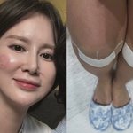 이혜원, 얼굴 갈아먹은 근황 “<b>SOS</b>”…부상 상태 보니 [DA]