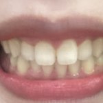 <b>돌출입</b>+무턱 한 번만 봐줘