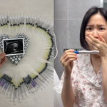 '자궁암' 초아, 기적적인 '쌍둥이 임신' 후.."모든 약+주사...