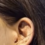 귀 이거 왜이러는 거야