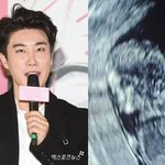 '<b>행인</b> 폭행→기소유예' 산이, 겹경사 알렸다 "나도 몰랐는데…임밍...