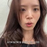 [드루와] '하시4' 김지영 "젊은 <b>녹내장</b> 환자, 병원 올 때마다...