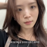 '하시4' 김지영, 녹내장 고백 “아빠도 환자..6개월마다 검진"...