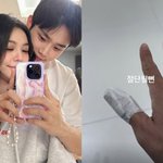 "에<b>일리</b> 잃을 뻔" 최시훈, 이번엔 손 다쳤다…아찔한 신혼생활