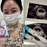 오초희, 유산 한달만 쌍둥이 임신 "로또 맞아