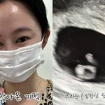  <b>유산</b> 한 달 만에 쌍둥이 임신…"선물같은 기적" [RE:스타]