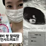 유산 한달 만에..'0.4% <b>확률</b>' 일란성 쌍둥이 임신 "이건...