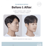 [댓글부탁해] 남자들 성형이 더 <b>드라마틱</b>한듯