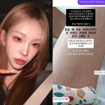 "튼살로 비키니 못 입어"…故최진실 <b>딸</b>, 피부 공개하며 "징그럽죠"