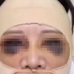 성형하다가 판다 됐어요… 제발 성형할 때 <b>신중</b>하세요 ㅠㅠ