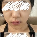 [댓글부탁해] 팔자<b>주름</b>있는 애들아 살빼