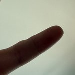 나 폰 땜에 새끼손가락 <b>변형</b>됨..