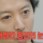‘빨간 눈’ 이동건, 1% 희귀병 진단 "송곳으로 찌르는 고통"...