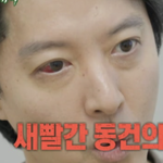 진단.."시뻘건 눈, 송곳으로 찌르듯 아프다" [<b>Oh</b>!쎈 이슈]