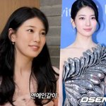 "결막모반 의심" 수지, 흰자에 '눈동자 점' 제거했다! [핫피플]