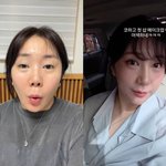‘<b>구축</b> 피해’ 허안나, 재성형 후 달라진 얼굴 “누구세요?”