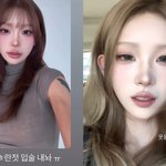 최준희, 입술 필러 녹였다‥<b>옹졸</b>해진 입에 당황 “중딩 얼굴 나오네”