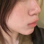 [댓글부탁해] <b>인중</b> 튀어나온 애들아