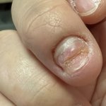 혐주의)<b>손톱</b> 너무 징그러워?