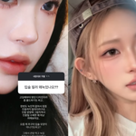 '41kg 뼈말라' 최준희, 눈+윤곽 성형하더니 입술필러 싹녹였다...