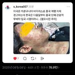 [댓글부탁해] 약혐주의) 이것 때문에<b>라도</b> 입국 막아야 하는 거 아님?