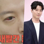 "<b>인구</b>1% 희귀병=유전" 이동건 딸 로아 어쩌나..'걱정vs확대해석'...