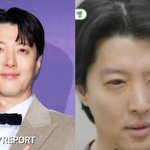  1% 희귀병 <b>진단</b>→완치 불가…"평생 관리 필요" ('미우새')