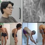 '완치불가' 이동건 투병 중인, '1%희귀병' 사진 '충격'.."송곳...