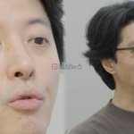 ‘미우새’ 이동건, 희귀병 강직성 척추염 진단…<b>인구</b> 1%만 발병...