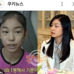 <b>성형의혹</b>  연예인