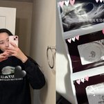  결혼 17년만 둘째 ‘<b>임밍아웃</b>’ “두 번의 아픔 겪어..안도와...