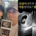 '40세 <b>자연</b>임신' 강은비, 첫 심장 소리에 울컥 "작고 소중...